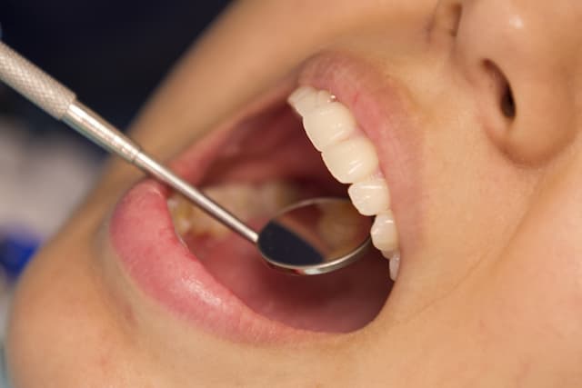 Gum Disease Bacteria May Cause Heart Valve Calcification