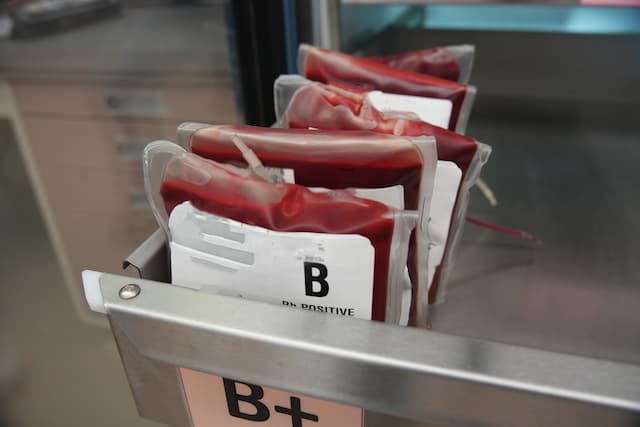 Earlier Blood Transfusions Cut Heart Failure Risk in Cardiac Surgery Patients