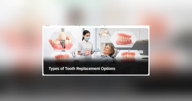 Affordable Dental Implants: A Practical Guide to Restoring Your Smile