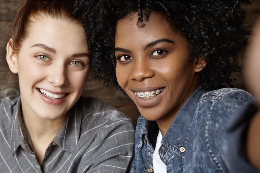 Exclusive Dynaflex Norris Brackets Now Only at Seacoast Braces