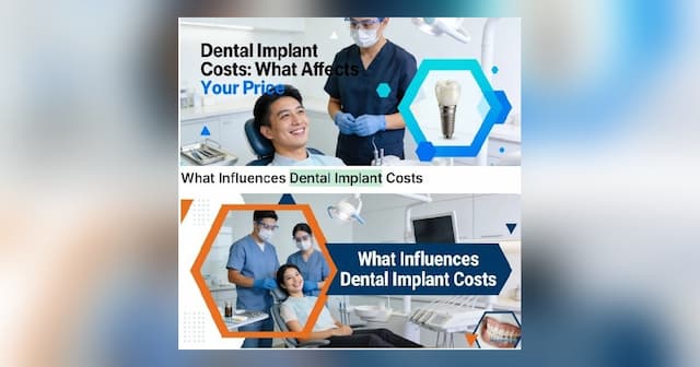How to Save on Dental Implants Without Sacrificing Quality