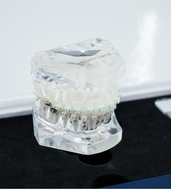 Revolutionize Your Smile with Lightforce Braces in Marlboro
