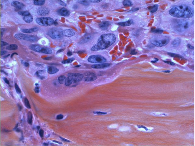Theriva™ Biologics Hits Several Milestones in 2023, Positioning Itself for Growth as the Firm Targets Difficult-to-Treat Cancers