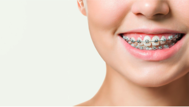 DentalPlans.com Offers Affordable Braces for American Parents