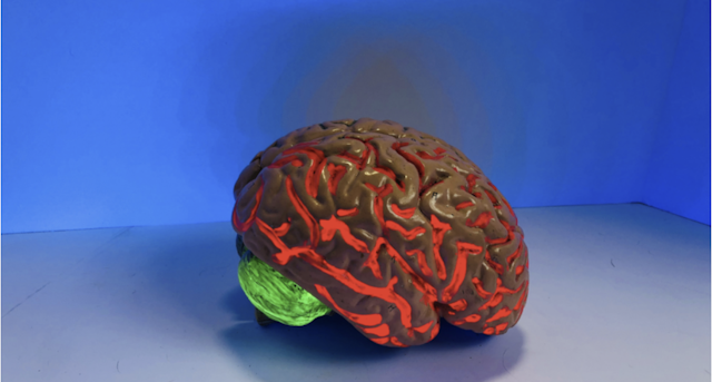 NeuroOne's Innovative Electrode Brain Monitoring Revolutionizes Neurological Disorders