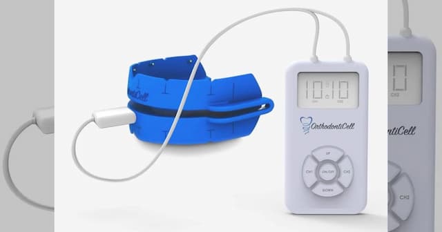 OrthodontiCell Secures Funding for Phase II Pivotal Study of Bioelectric Tooth Movement Tech